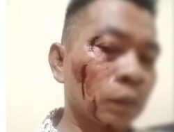 Jadi Korban Pengeroyokan Biadab 2 Oknum Ustad, Wartawan Sumenep Lapor Polisi 